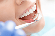 Professional teeth whitening